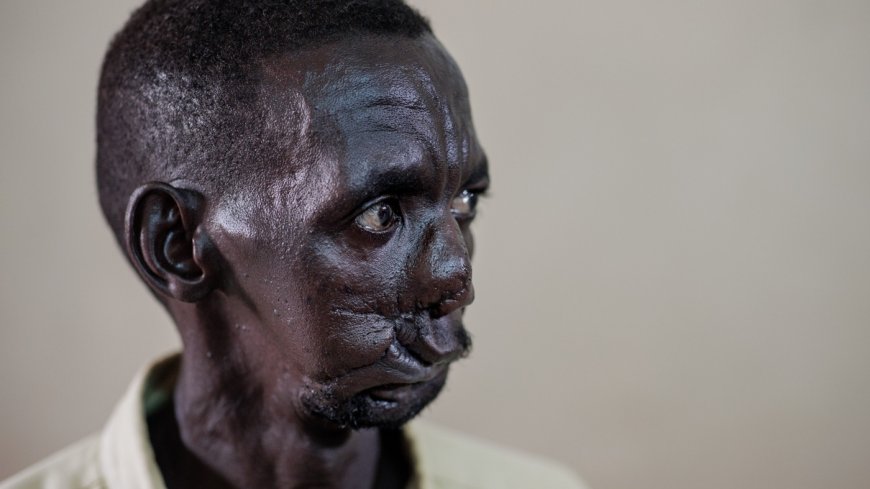 In Pictures: How one hospital is faring as Sudan's health care system is devastated by war