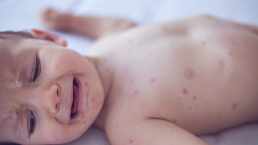 US vaccinations fall again as more parents refuse lifesaving shots for kids