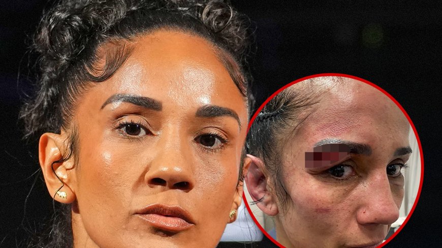 Amanda Serrano Shares Gruesome Injury Pic After Loss to Katie Taylor