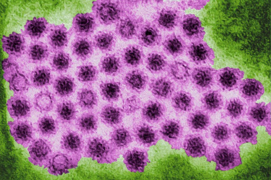 Will an mRNA vaccine target the norovirus strain behind surging cases?